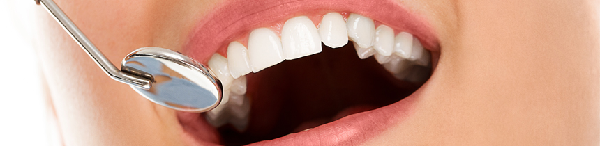 Inlays für die Zähne - Zahnärzte-Zentrum Hiltrup